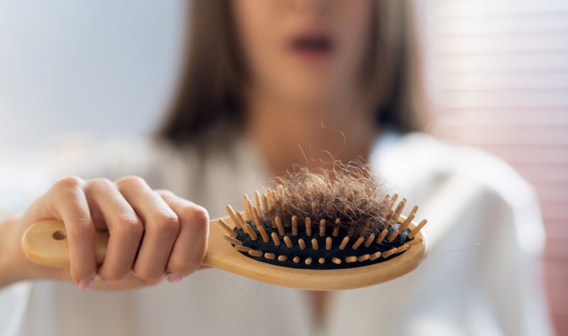 ریزش مو تا چه حد طبیعی است؟ بررسی علمی و راهکارهای مراقبتی