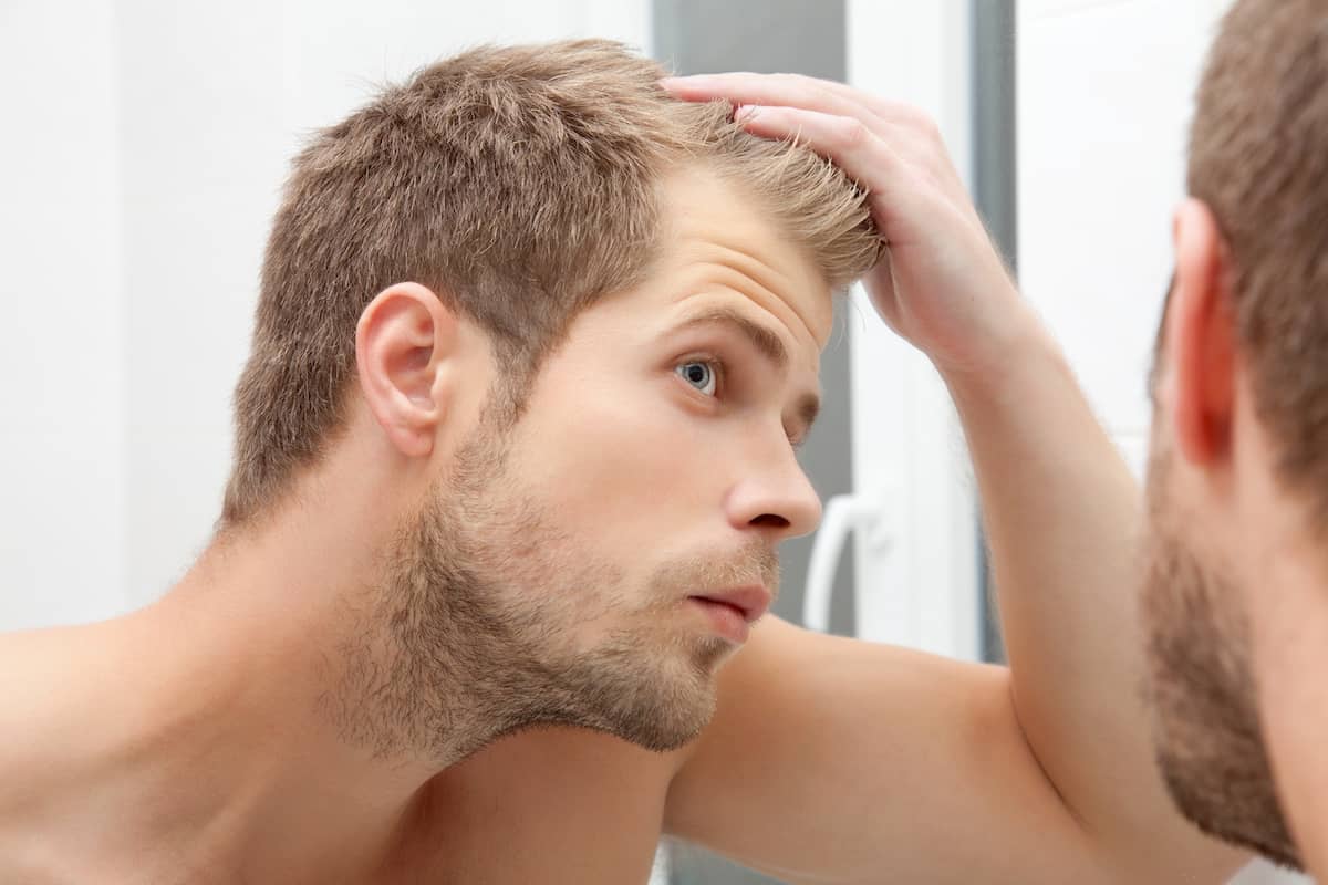 بهترین سن برای کاشت مو؛ چه زمانی باید اقدام کنیم؟