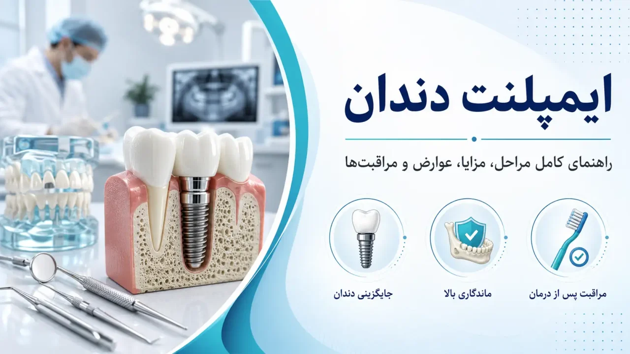ایمپلنت دندان چیست؟ راهنمای کامل مراحل، مزایا، عوارض و مراقبت‌ها