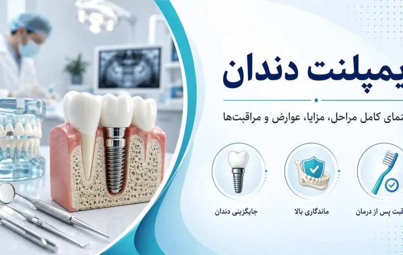 ایمپلنت دندان چیست؟ راهنمای کامل مراحل، مزایا، عوارض و مراقبت‌ها