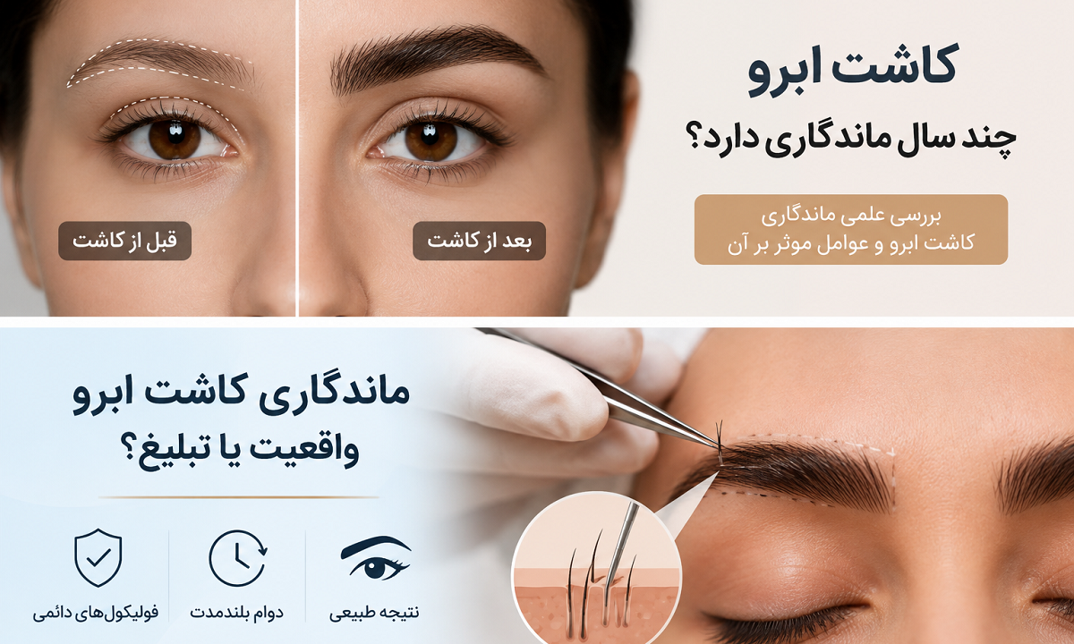 کاشت ابرو چند سال ماندگاری دارد؟ آیا نتیجه واقعاً دائمی است؟