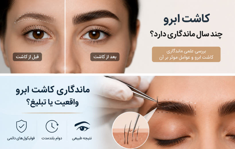 کاشت ابرو چند سال ماندگاری دارد؟ آیا نتیجه واقعاً دائمی است؟