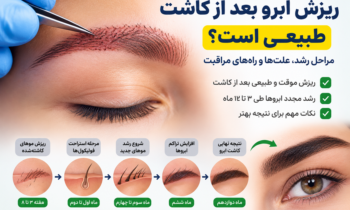 ریزش ابرو بعد از کاشت طبیعی است؟ بررسی علت‌ها، زمان شروع رشد و راه‌های مراقبت
