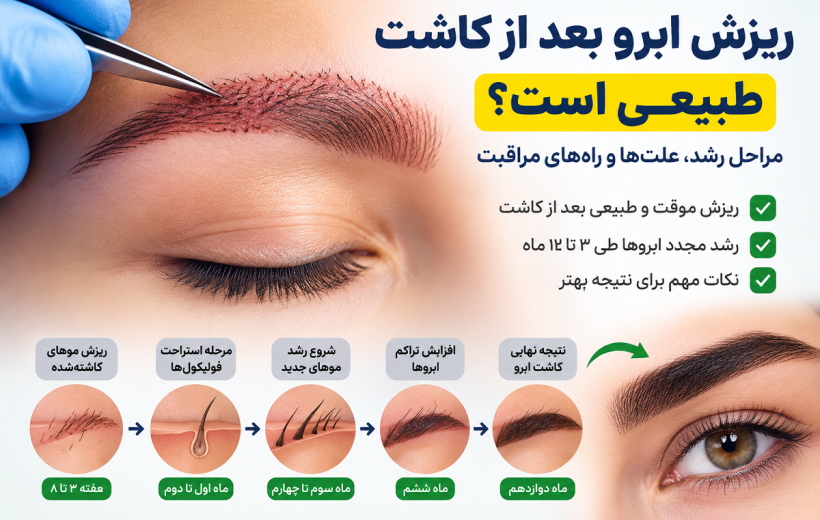 ریزش ابرو بعد از کاشت طبیعی است؟ بررسی علت‌ها، زمان شروع رشد و راه‌های مراقبت