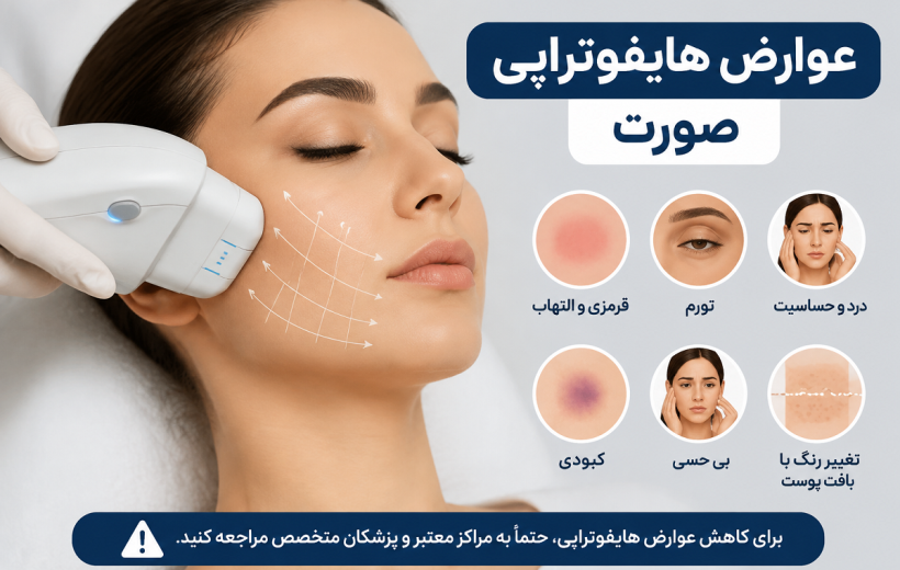 عوارض هایفوتراپی صورت چیست؟ بررسی خطرات، مراقبت‌ها و نکات مهم قبل از انجام HIFU