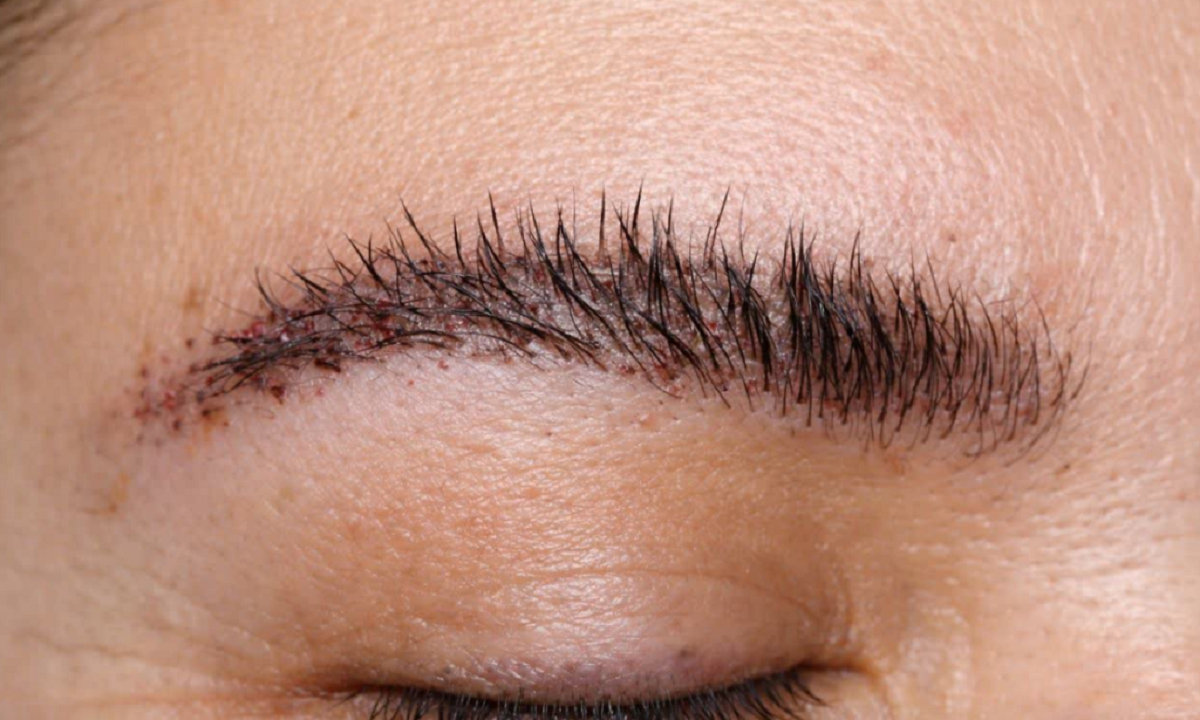 چرا ابروی کاشته شده سیخ می‌شود؟ دلایل واقعی و راه‌های اصلاح فرم ابرو