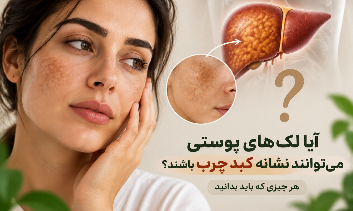 آیا لک‌های پوستی می‌توانند نشانه کبد چرب باشند؟ هر چیزی که باید بدانید