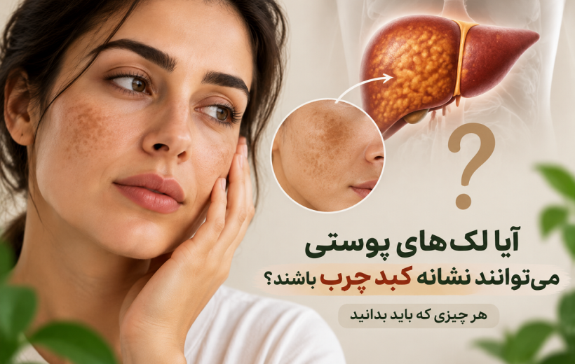 آیا لک‌های پوستی می‌توانند نشانه کبد چرب باشند؟ هر چیزی که باید بدانید