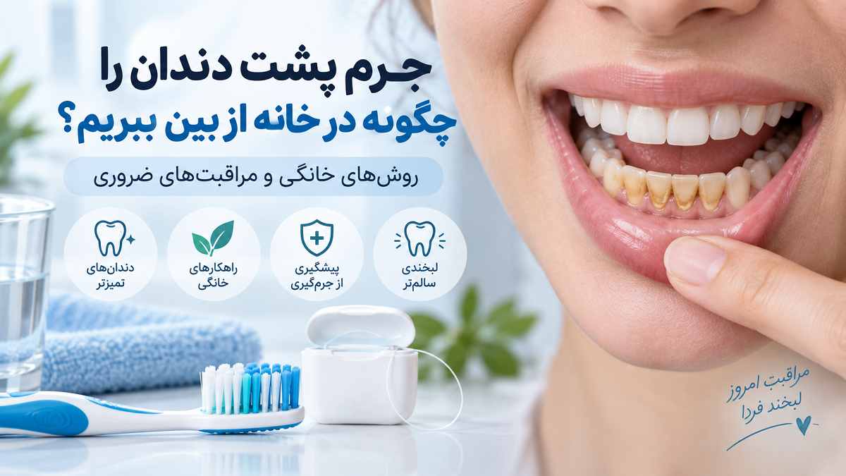 جرم پشت دندان را چگونه در خانه از بین ببریم؟ روش‌های خانگی و مراقبت‌های ضروری