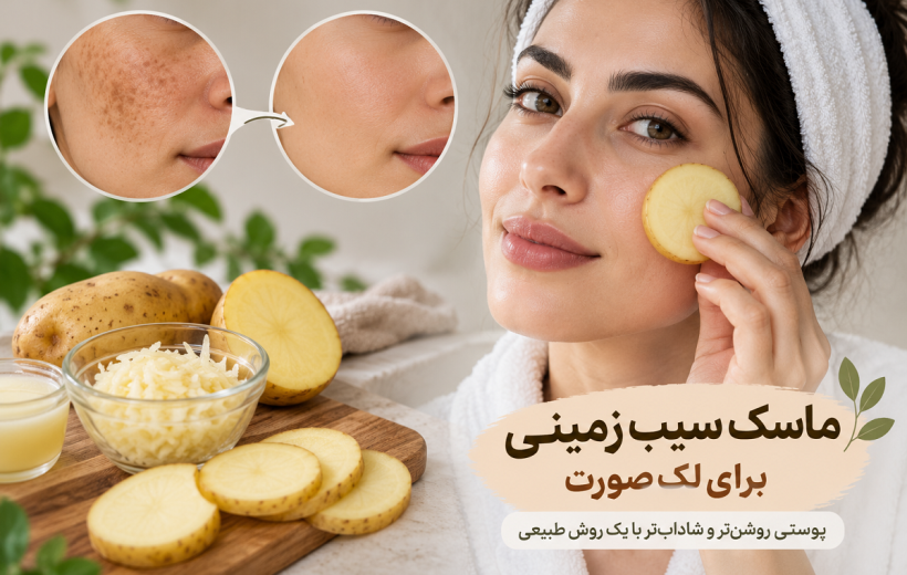 ماسک سیب زمینی برای لک صورت؛ روش تهیه و تاثیر آن بر روشن شدن پوست