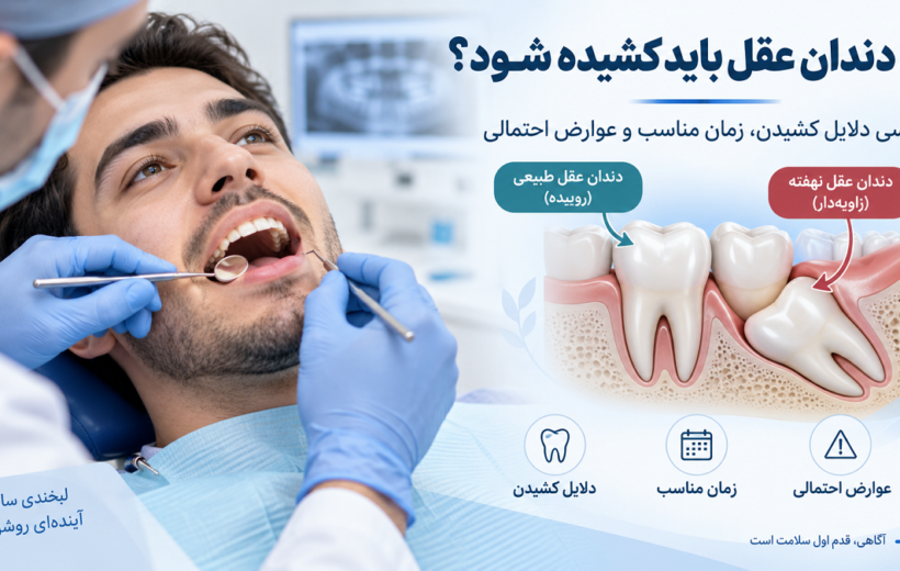 آیا دندان عقل باید کشیده شود؟ بررسی دلایل کشیدن، زمان مناسب و عوارض احتمالی