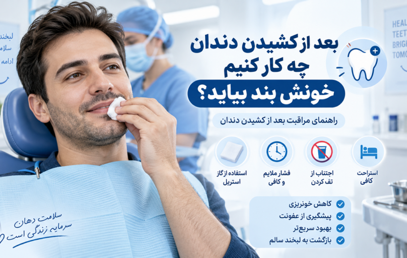 بعد از کشیدن دندان چه کار کنیم خونش بند بیاید؟ راهنمای کامل مراقبت بعد از کشیدن دندان