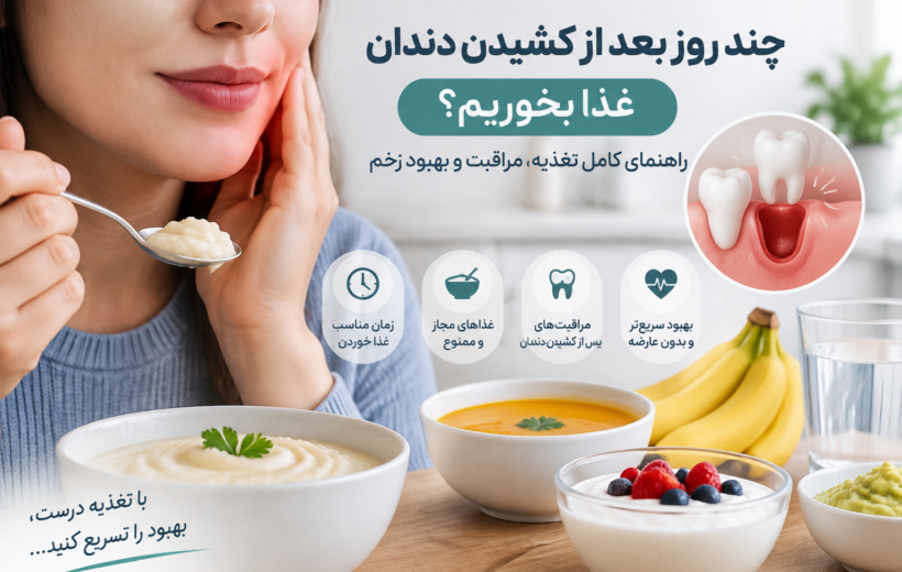 چند روز بعد از کشیدن دندان غذا بخوریم؟ راهنمای کامل تغذیه، مراقبت و بهبود زخم